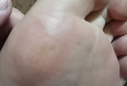 去除鸡眼视频,跟随视频教程学除法